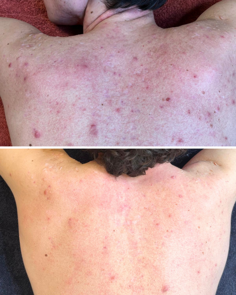 soin anti imperfections dos homme